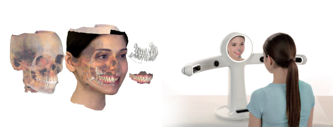 RAYFace dental facial scanner