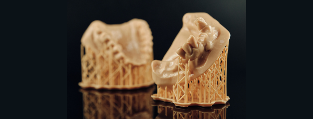 3d printed dental model