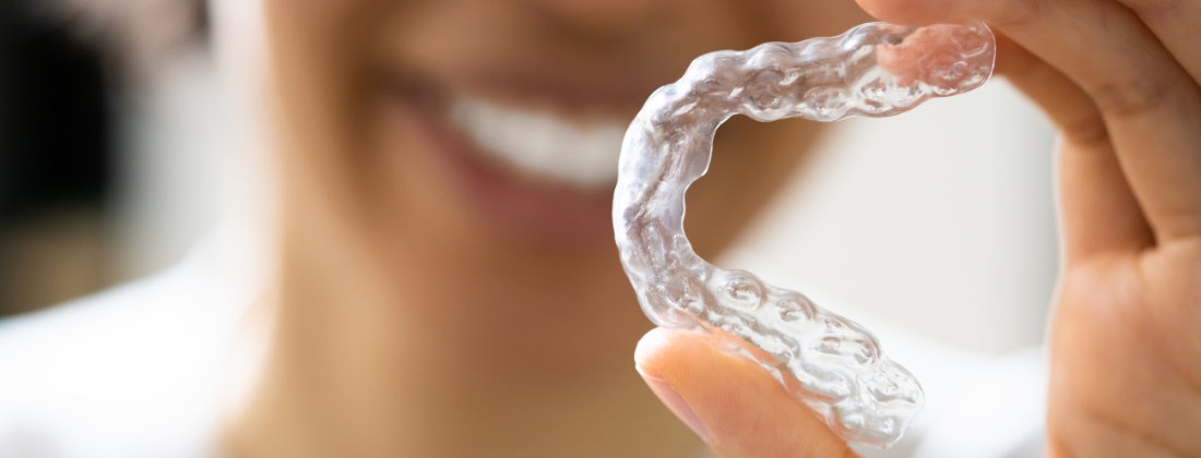 clear aligners