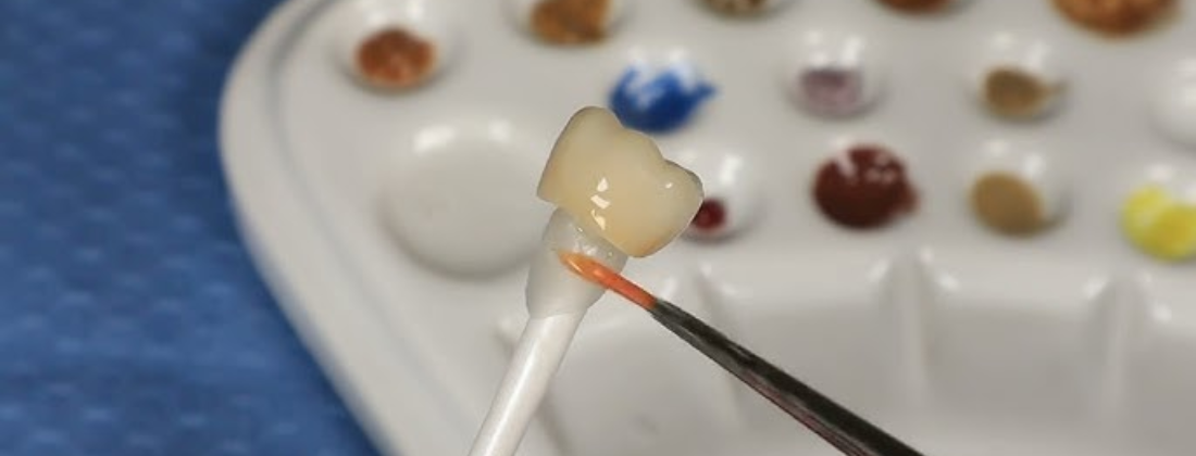 stain and glaze zirconia crown