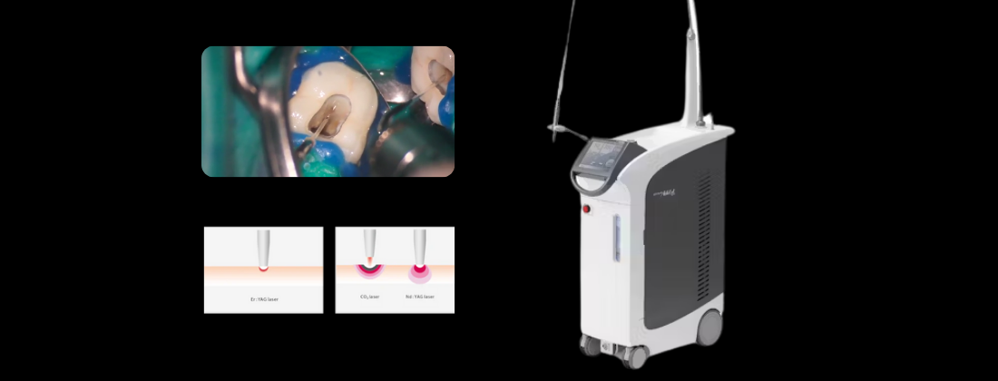 er:yag laser