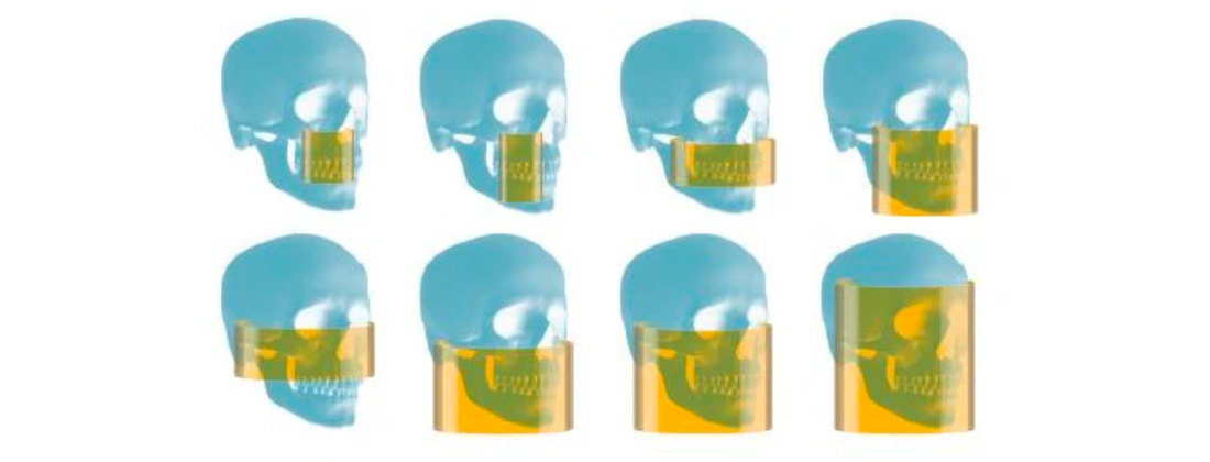 cbct field of view