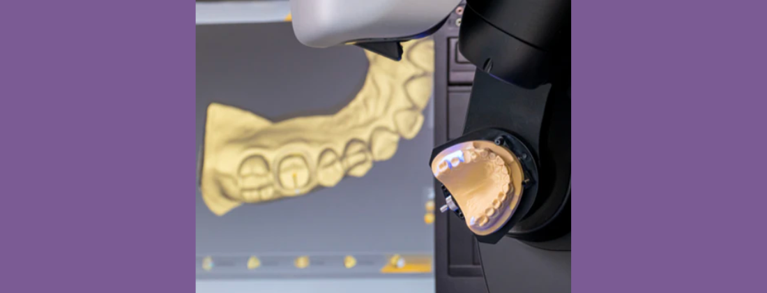 cad cam dental restorations