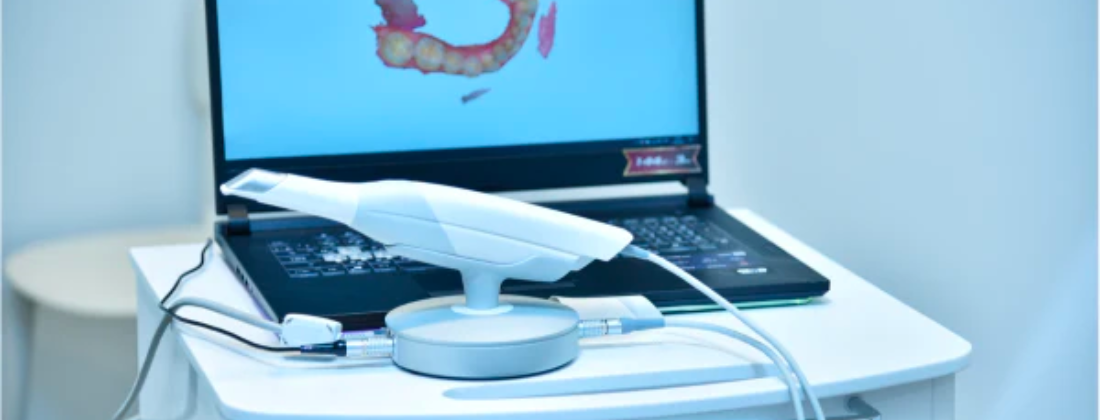 intraoral scanner