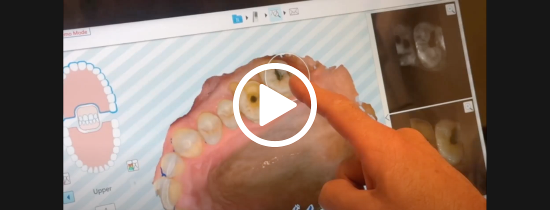 restorative dentistry