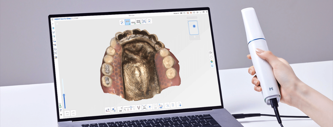 medit i900 intraoral scanner