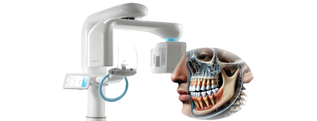 rayscan vision 20 cbct