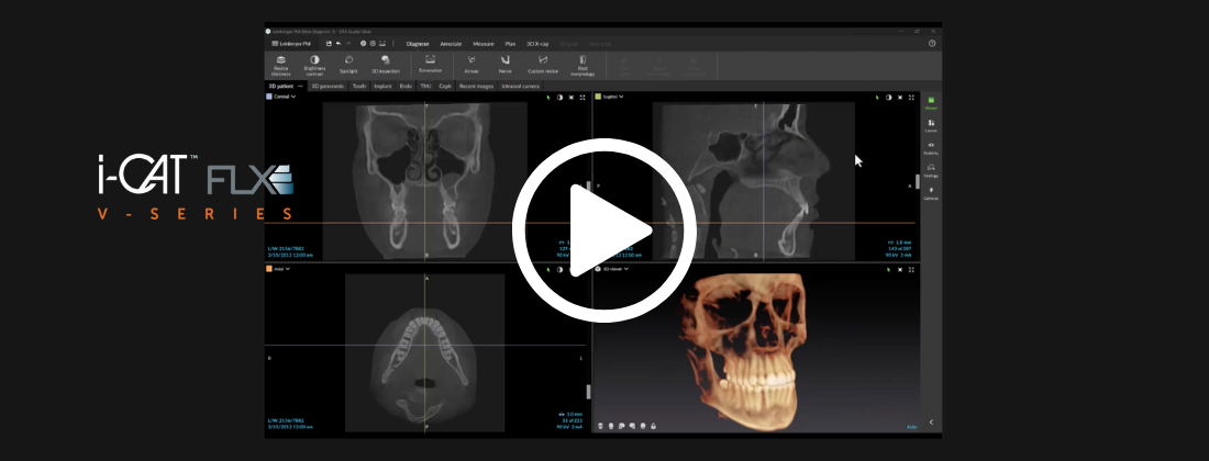 i-cat flx low dose workflows