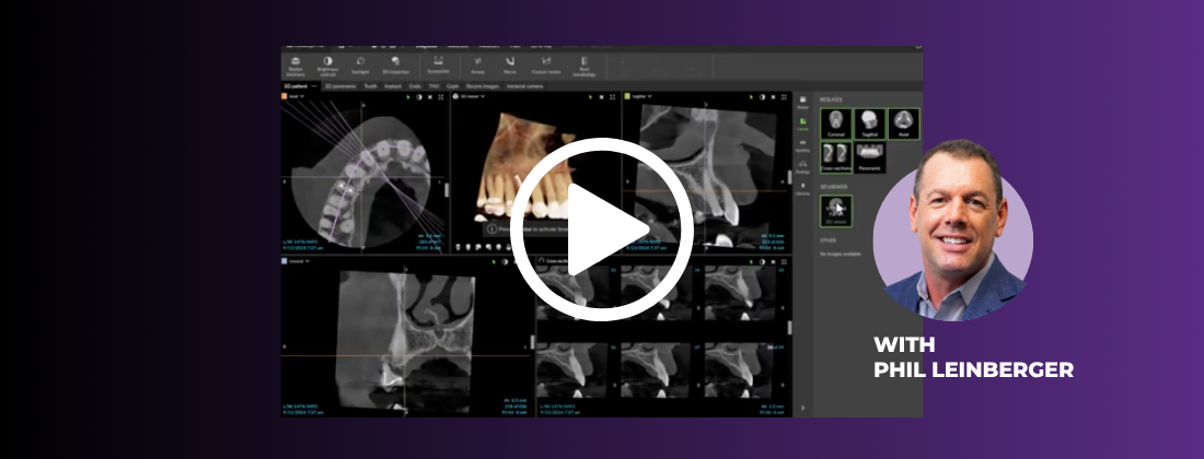 dexis dtx studio endodontics