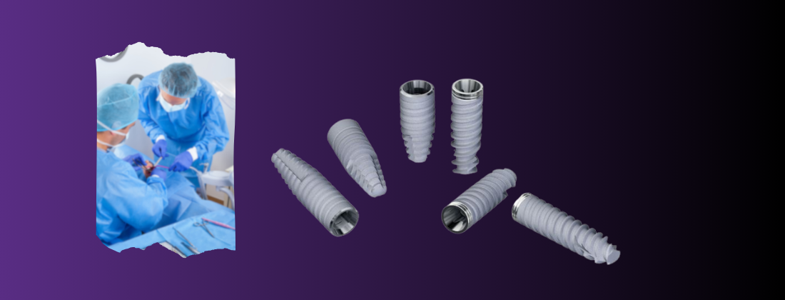 dess dental implants